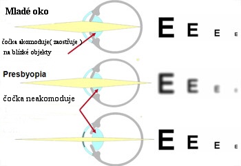 Optika Vaněčková s.r.o. - Presbyopie a její korekce